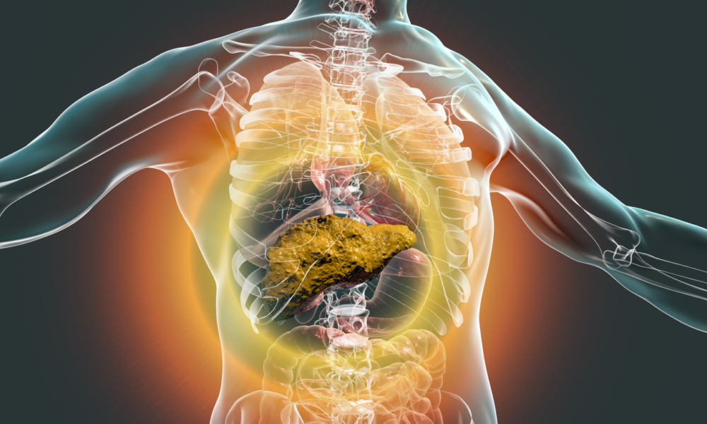 Strategies for Managing Cirrhosis and Preventing Complications