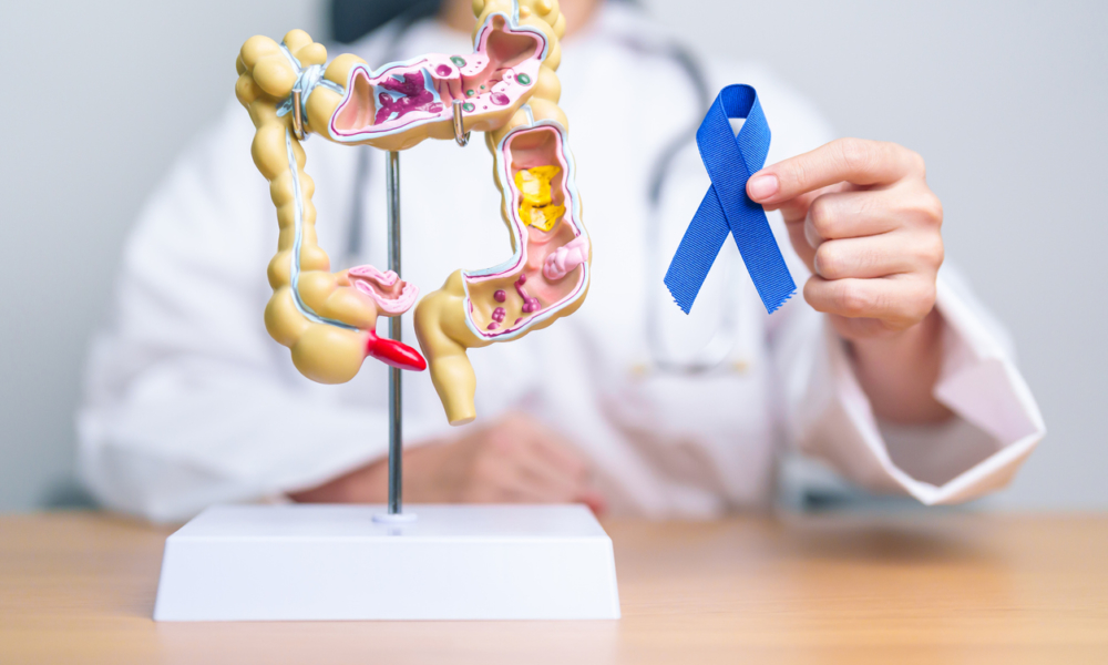 Colorectal Cancer Awareness Month